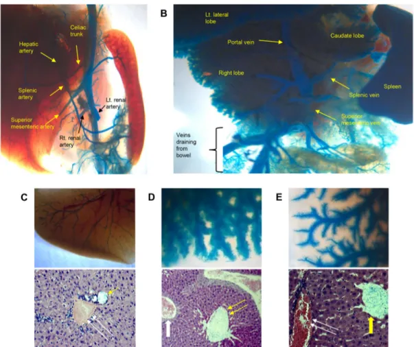 Fig 1. Selective angiography using blue latex dye. (A) Systemic arteriography and (B) direct portography in a wild-type mouse