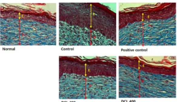 Fig. 23. The  Effects  of  DCL  on  Skin  Thickness  in  the  DNCB-induced  AD  Mice