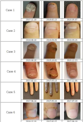 Fig.  1.  Photographs  of  Lesions