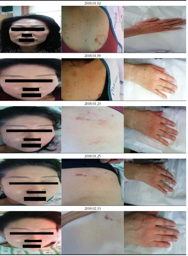 Fig. 1. Pictures of Skin Lesion