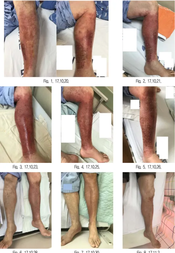 Fig. 1. 17.10.20. Fig. 2. 17.10.21.