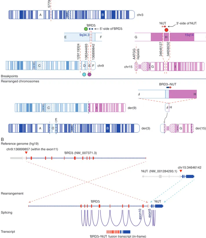 Figure 3. Pattern of chromosomal rearrangement involving the BRD3NUT rearrangement and its transcription in NMC2