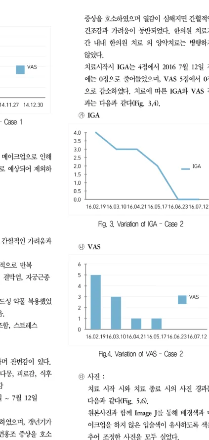 Fig. 2. Variation of VAS – Case 1