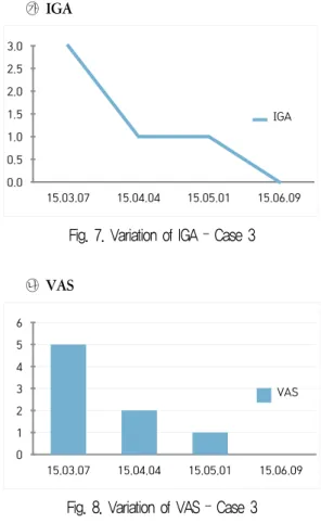 Fig. 7. Variation of IGA – Case 3