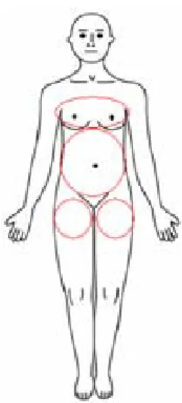Fig. 1. The lesions and range of case 1