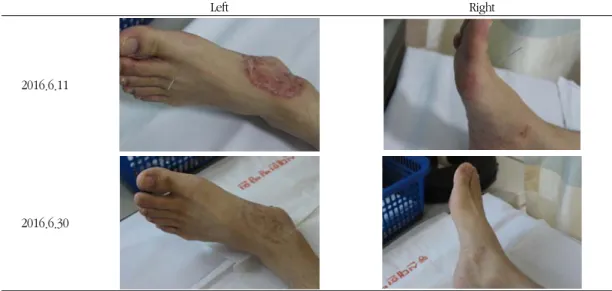 Fig. 1. Progress of case (Case 1)