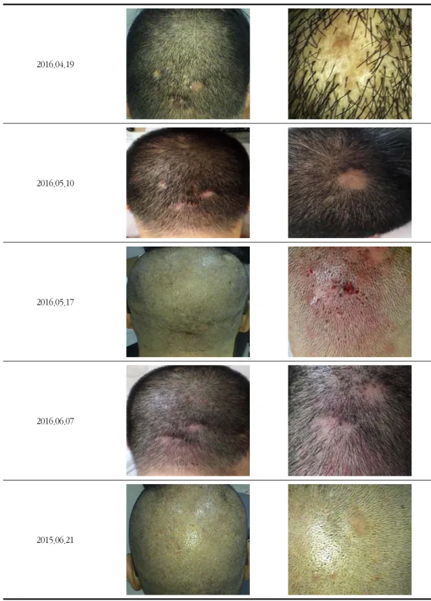 Fig. 3. The progress of treatment 
