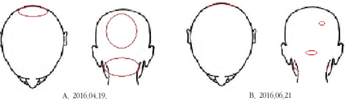 Fig. 5. The variation of VAS