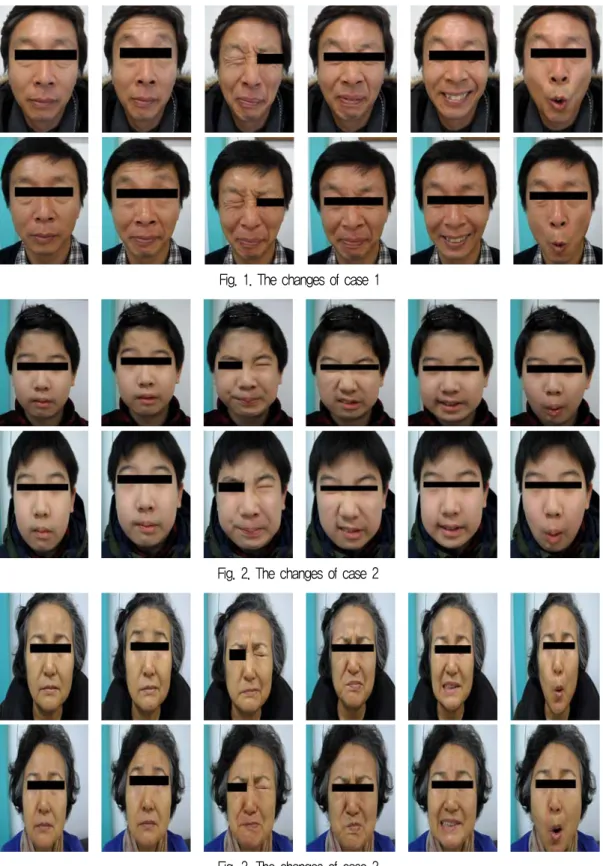 Fig. 1. The changes of case 1 