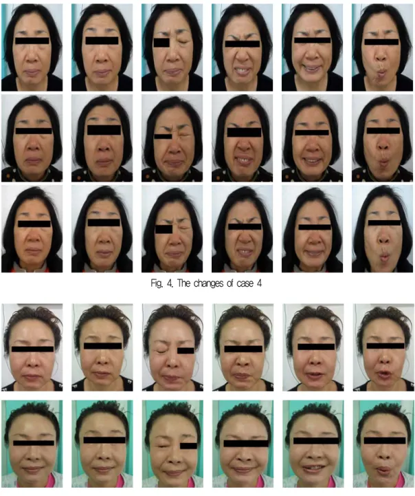 Fig. 4. The changes of case 4