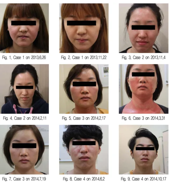 Fig. 1. Case 1 on 2013.6.26 Fig. 2. Case 1 on 2013.11.22 Fig. 3. Case 2 on 2013.11.4