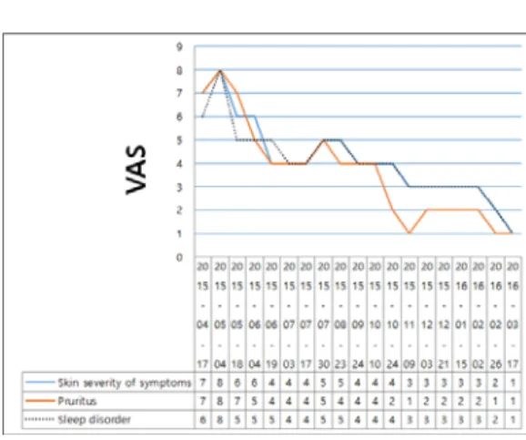 Fig. 1. Variation of VAS – case 1