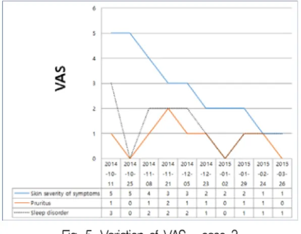 Fig. 5. Variation of VAS – case 3