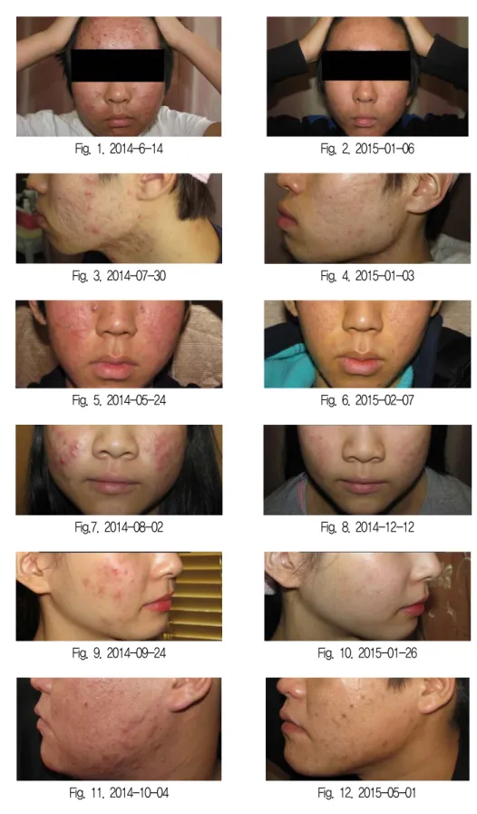 Fig. 1. 2014-6-14 Fig. 2. 2015-01-06 Fig. 3. 2014-07-30 Fig. 4. 2015-01-03 Fig. 5. 2014-05-24 Fig