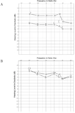 Fig. 2. Pure tone audiometry progress of case 1 