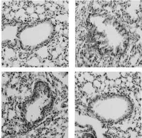 Fig. 2. Effect  of  GME  on  methacholine-induced  airway  hyper-reactivity (AHR) in asthmatic mice model.