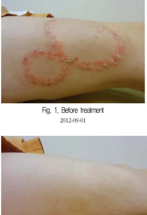 Fig. 1. Before treatment 