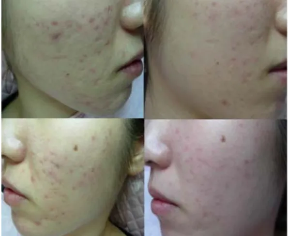 Fig. 2. Before and after treatment