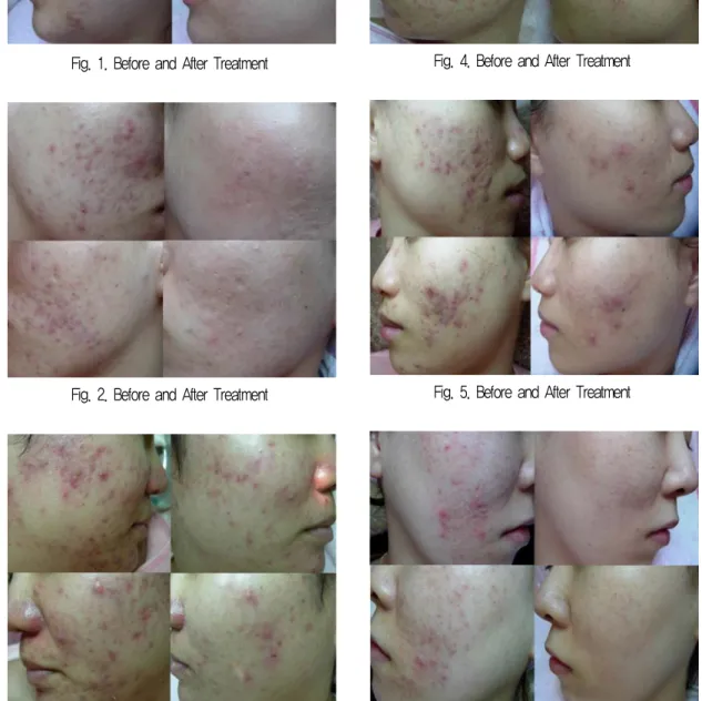 Fig. 3. Before and After Treatment