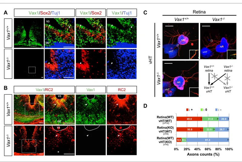 Figure 1. Vax1 regulates RGC axonal growth in a non-cell autonomous manner. (A) Cells expressing Vax1 (green) in brain sections (coronal; 16  μm) from  E14.5 Vax1 +/+  (top) and Vax1 −/−  (bottom) embryos were detected by co-immunostaining for the NPC mark