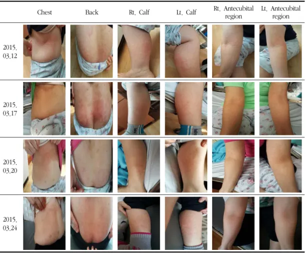 Fig. 1. The progress of treatment