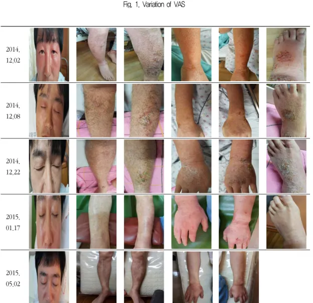 Fig. 2. The progress of treatment