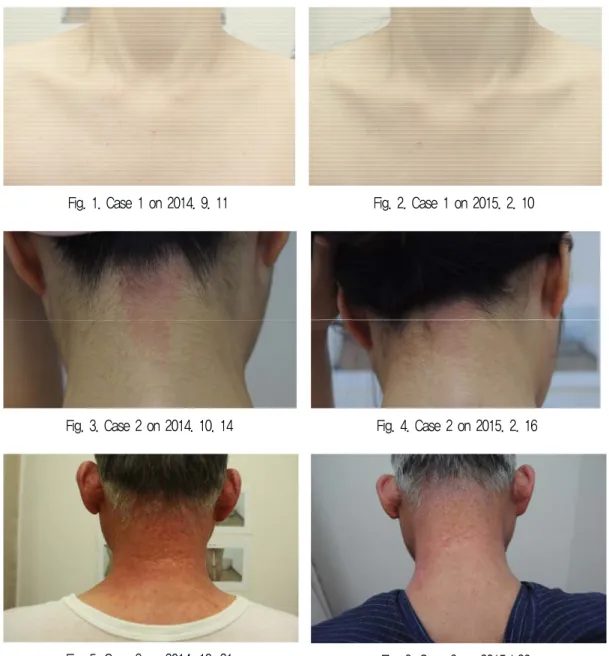 Fig. 1. Case 1 on 2014. 9. 11 Fig. 2. Case 1 on 2015. 2. 10