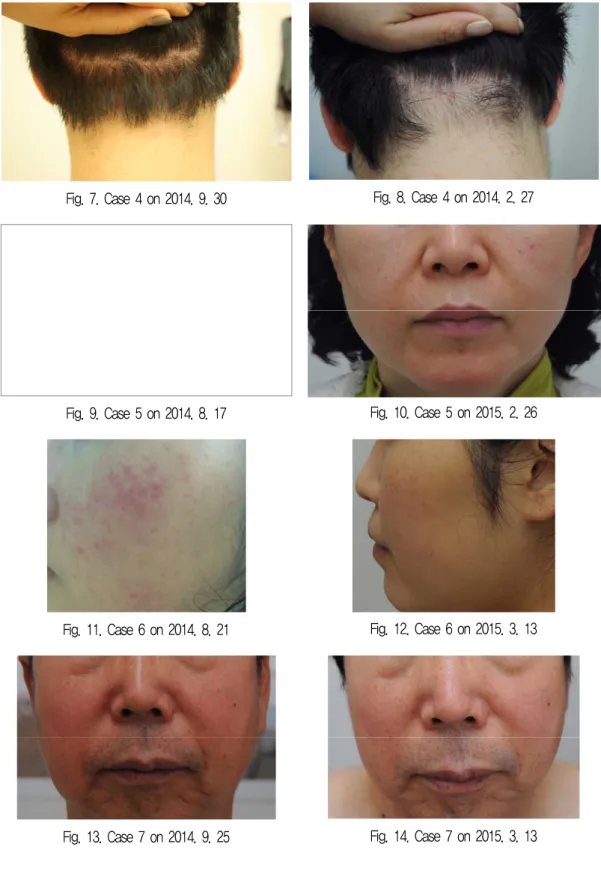 Fig. 7. Case 4 on 2014. 9. 30 Fig. 8. Case 4 on 2014. 2. 27