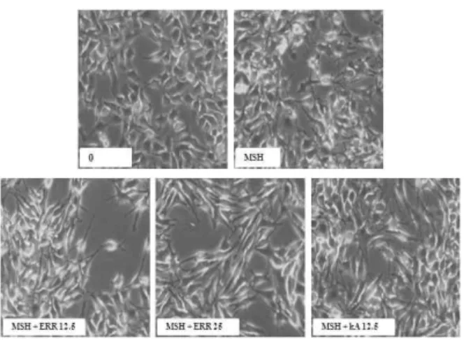 Fig.  2.  Light  micrographical  observation  of  B16F10  cells  after  treatment  with  ethanol  extract  of  Rosae  rugosae  Flos and α-MSH