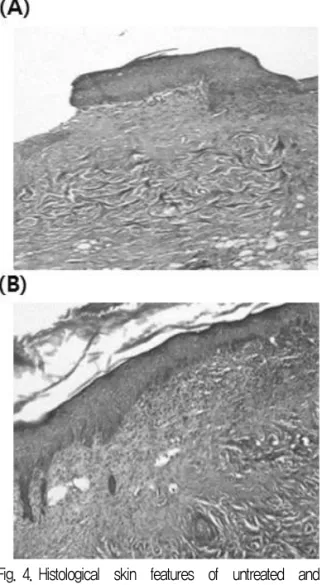 Fig.  5.  Hematologic  changes  of  White  Blood  Cell  in  the  burn-induced mice. 