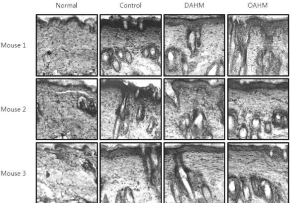 Fig.  13. Effects  of  herbal  mixture on  levels  of  blood IgE  in acute atopy dermatitis induced mice