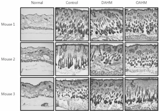 Fig.  9.  Comparison  of  the  histological  feature  of  hematoxylin  and  eosin-stained  dorsal  skin  sections in acute atopic dermatitis mice