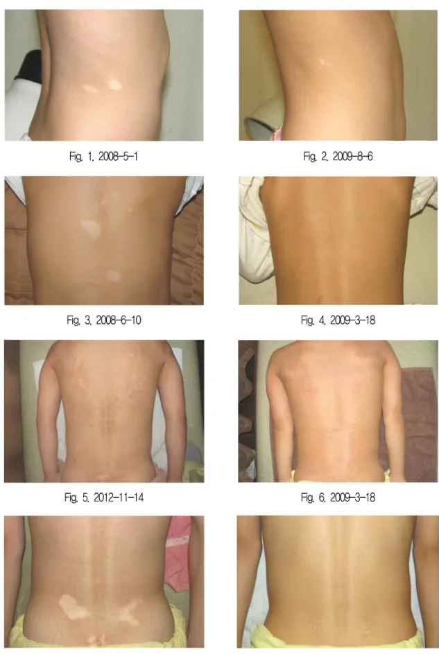 Fig. 1. 2008-5-1 Fig. 2. 2009-8-6
