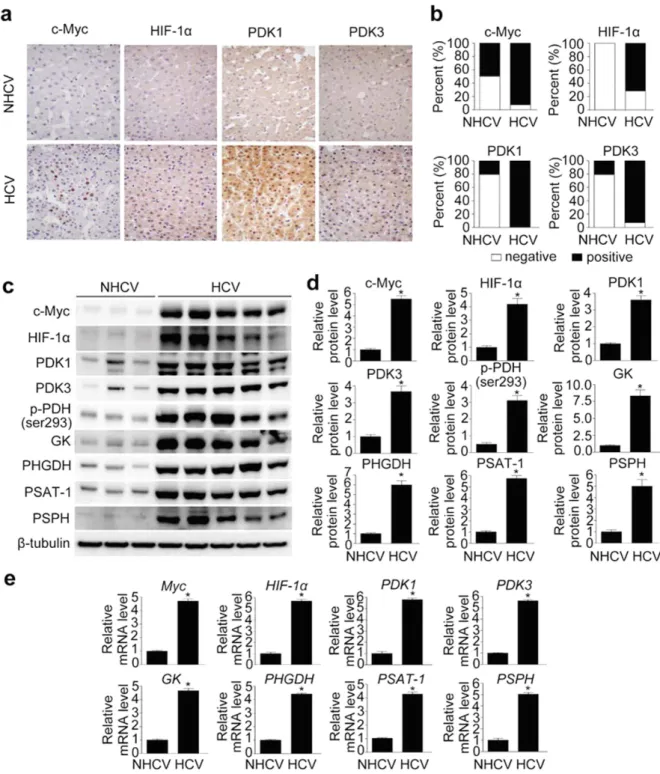 Figure 1.  HCV infection increases c-Myc, HIF-1α, PDK1, and PDK3 levels in human liver