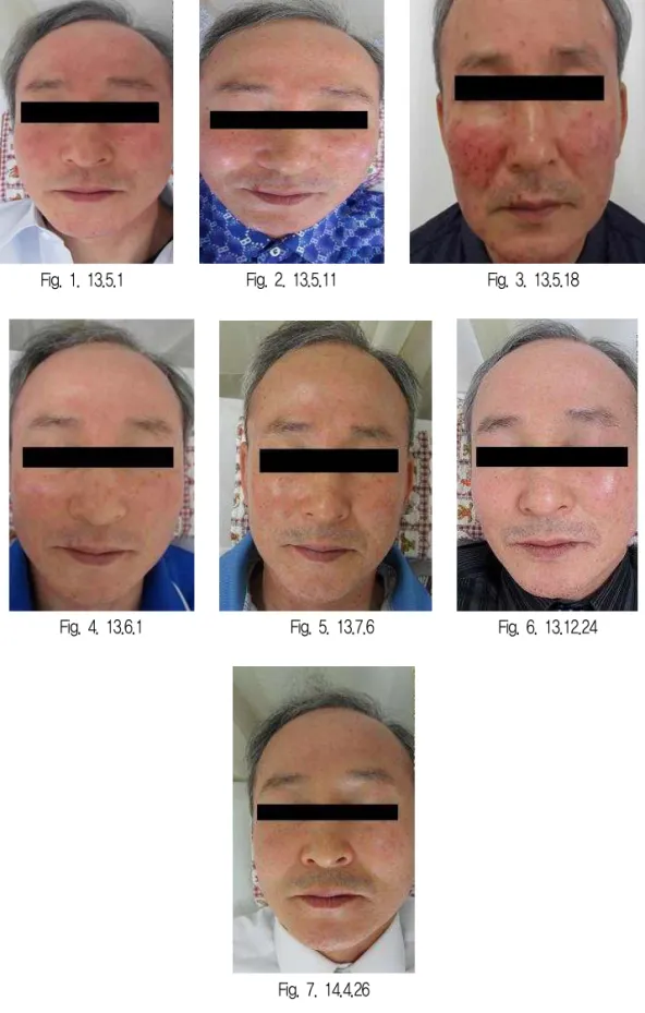 Fig. 1. 13.5.1       Fig. 2. 13.5.11       Fig. 3. 13.5.18 Fig. 4. 13.6.1         Fig
