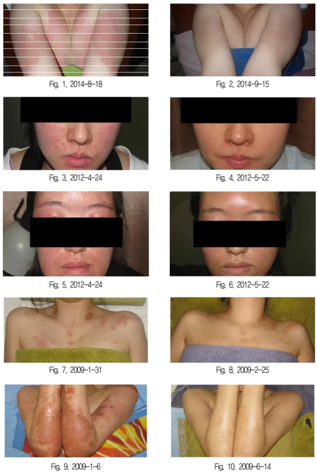 Fig. 1. 2014-8-18 Fig. 2. 2014-9-15