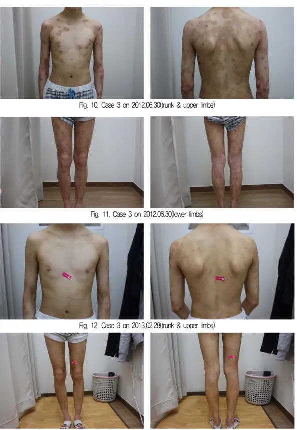 Fig. 10. Case 3 on 2012.06.30(trunk &amp; upper limbs)