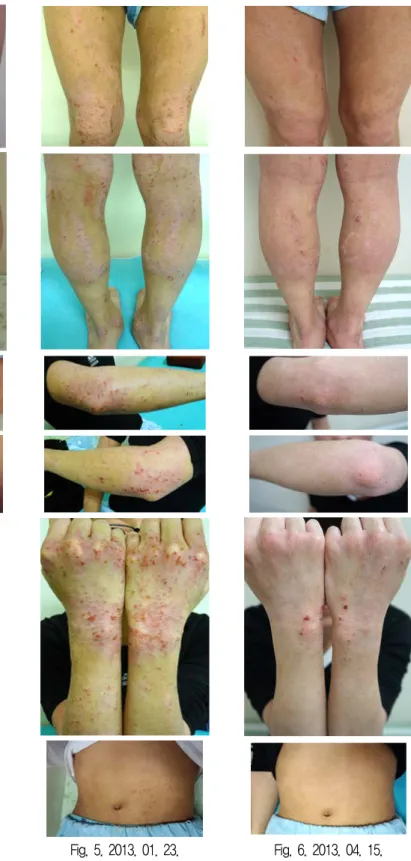Fig. 4. 2011. 11. 26. Fig. 5. 2013. 01. 23. Fig. 6. 2013. 04. 15.