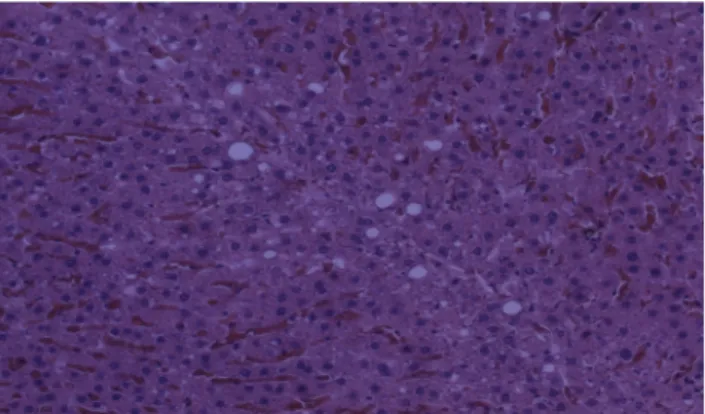 Fig. 2. Rat model of fatty liver tissue induced with H&amp;E stain