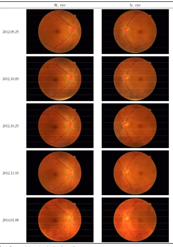Fig. 1. Progress of decreasing of optical disc swelling
