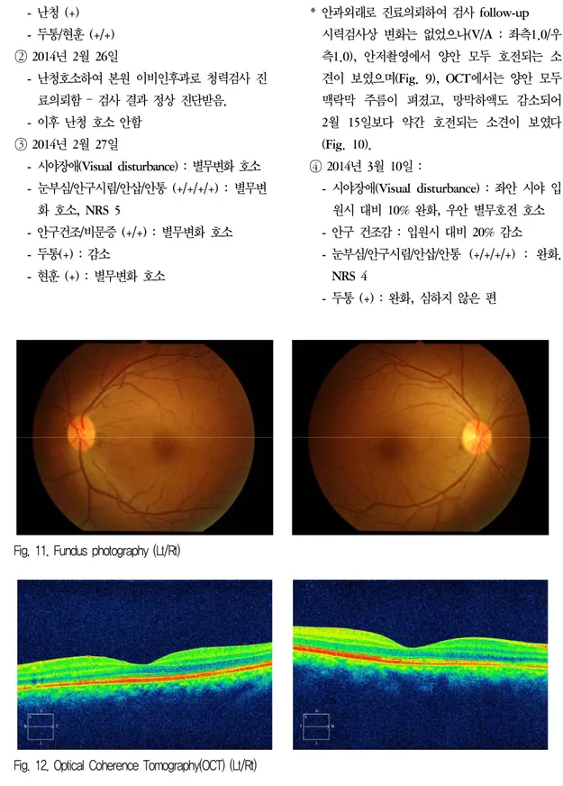Fig. 11. Fundus photography (Lt/Rt)   