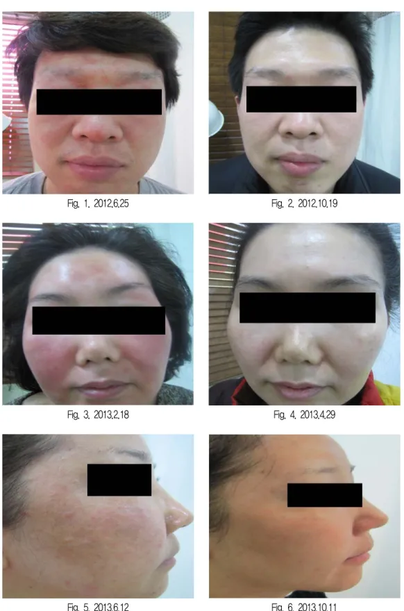 Fig. 1. 2012.6.25 Fig. 2. 2012.10.19
