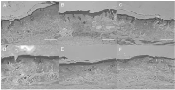 Fig.  3.  Histologic  analysis  of  allergic  contact  dermatitis  in  NC/Nga  mice  treated  with  SAE(×200)