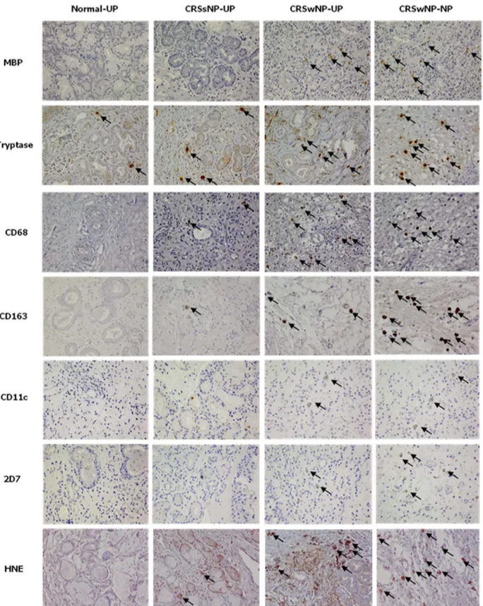 Figure 1. The immunohistochemical detection of innate immune cells was performed by using MBP, tryptase, CD68, CD163, CD11c, 2D7, and HNE (magnification x400)