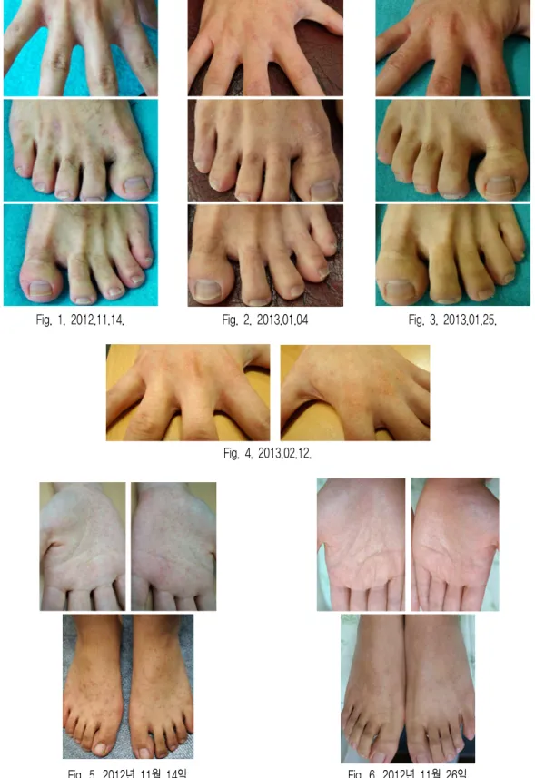 Fig.  1.  2012.11.14. Fig.  2.  2013.01.04 Fig.  3.  2013.01.25.