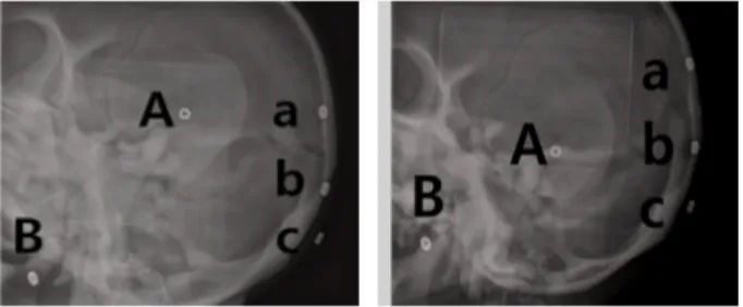 Fig.  4.  Image  with  metal  material  attached (a) Image of conventional method  (b) image using assistive devices