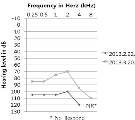 Fig.  1.  The  change  of  hearing  level 