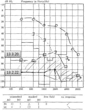 Fig.  2.  Pure  tone  audiogram