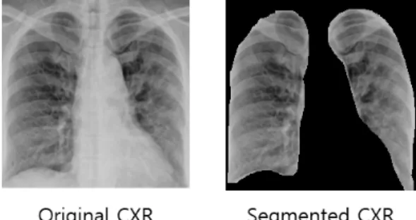 Fig. 4. Original CXR and Segmented CXR masked by Image  Labeler  application