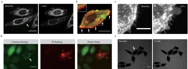 Figure 2 | Morphological characteristics of laser-induced cell death. (a) Mitochondrial fragmentation after laser stimulation